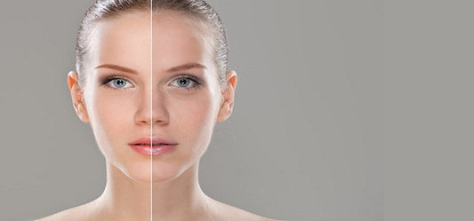 Home Remedies To Protect Your Skin From Sun Rays