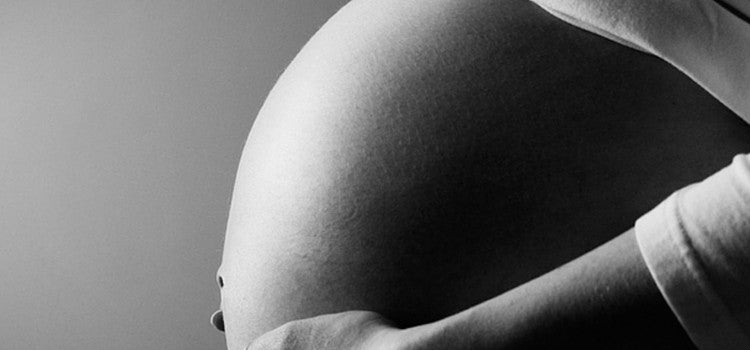Get rid of Stretch marks with 5 miraculous products