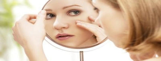How to Remove Blackheads at Home Naturally