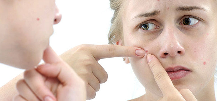 Useful Tips to Cure and Thwart Teenage Acne