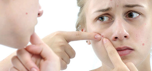 Useful Tips to Cure and Thwart Teenage Acne