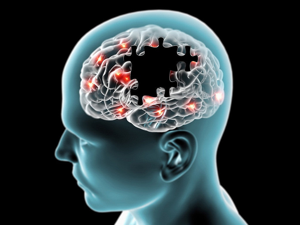 Switch to Organic Foods and Supplements to Prevent Alzheimer’s
