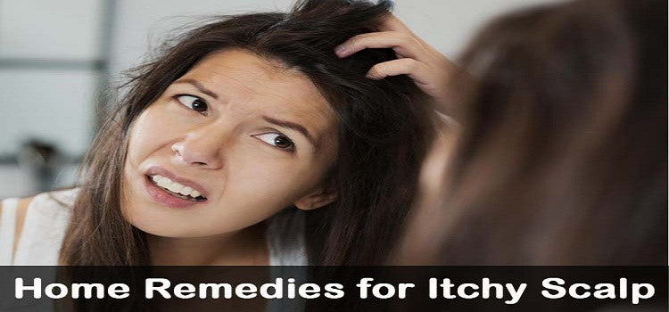 Home Remedies To Get Itch & Dandruff Free Scalp