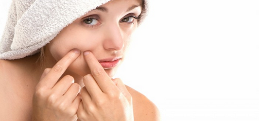Are Your Pimples Getting Inflamed? Try These Organic Remedies