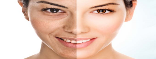 Anti-Ageing - Essential Skin Care Tips to Stop Ageing