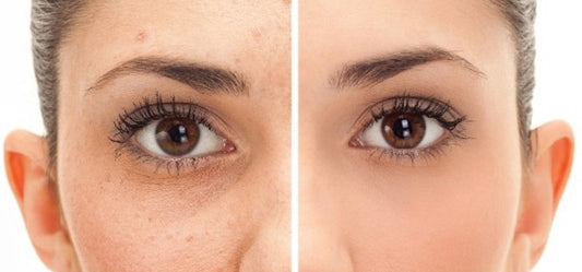 How to Lighten Injury Scars Naturally