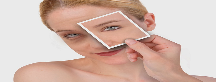 How To Get Rid Of Those Dark Circles The Organic Way