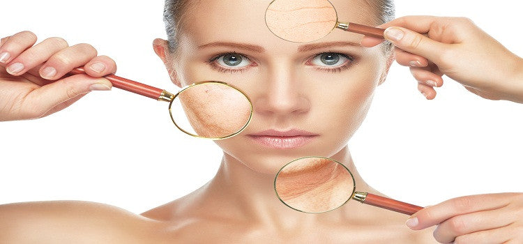 Depigmentation As An Anti-Marks Therapy