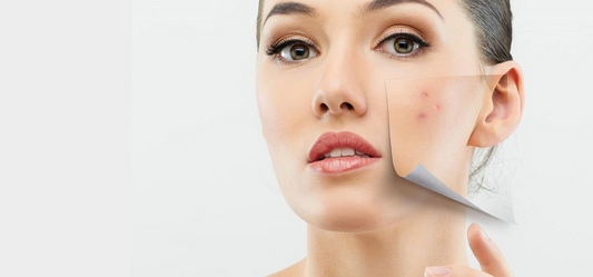 Tips to reduce sebum secretion