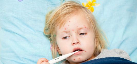 Tips to Cure Measles