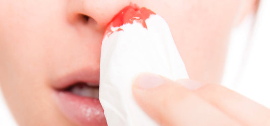 Home Remedies to Stop Nose Bleeding.