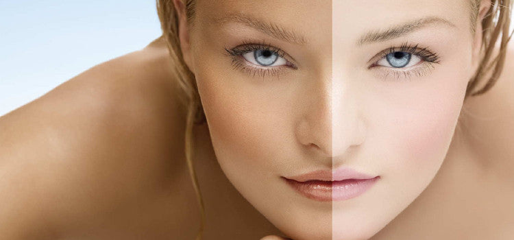 Simple Ways to Cure a Tanned Skin