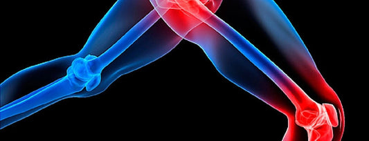 Stop being a victim of Arthritis. Try these remedies now.