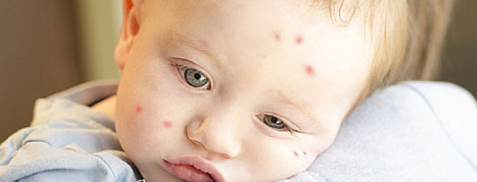 Do anti-mosquito patches really work?