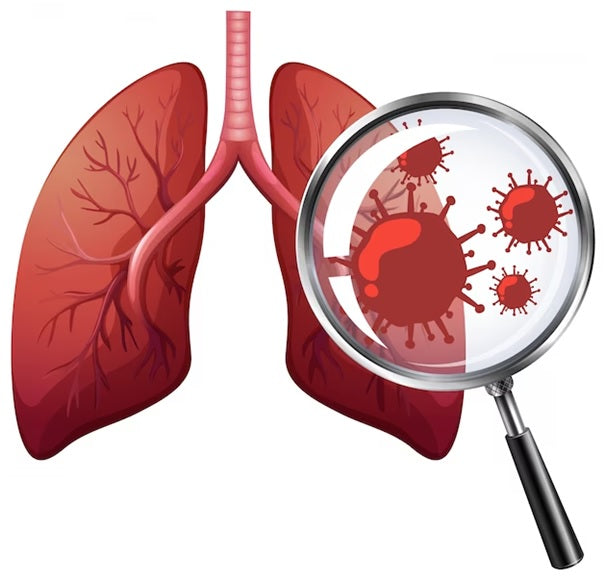 Why worry about Lung Cancer