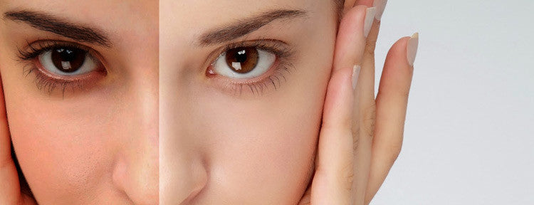 Why You Should Only Go for Organic Anti Tan Skin Care