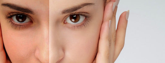 Why You Should Only Go for Organic Anti Tan Skin Care