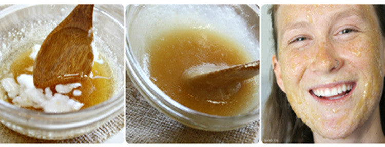 7 Natural Products to Reduce Acne Scars