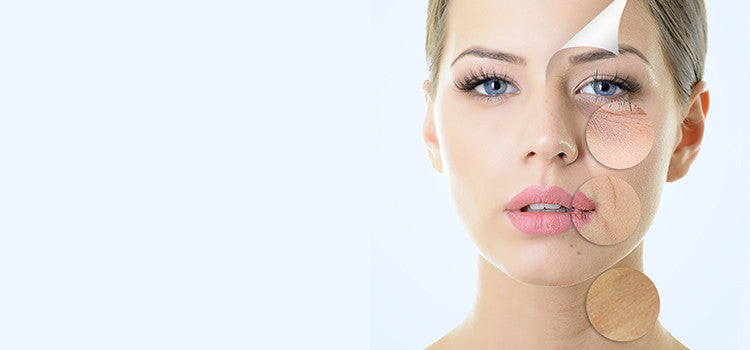 Natural Remedies for Treating Skin Scars