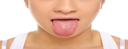 Sores in your mouth? Get rid of them with these natural products