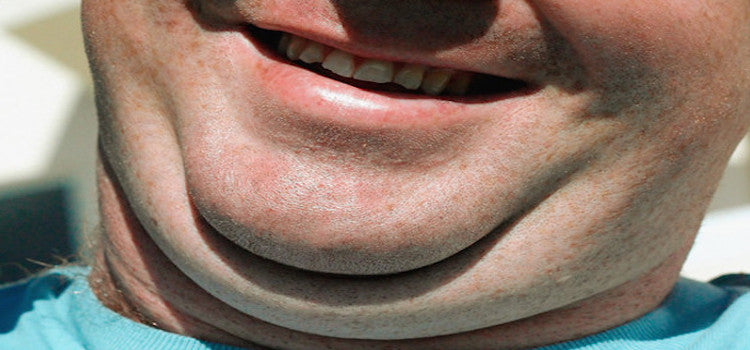 5 Home Remedies To Reduce Double Chin
