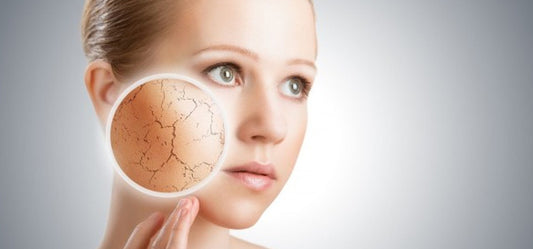 4 Natural Ways To Hydrate Your Dry Skin
