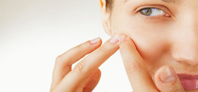 Say Good Bye To Acne Forever