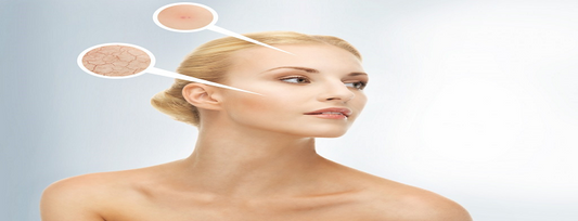 5 Best Products For Skin Care In Winter