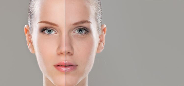 An organic solution to uneven skin tone