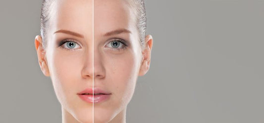 An organic solution to uneven skin tone
