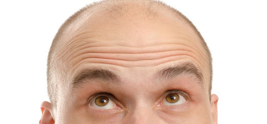 Methods of anti hair loss in males