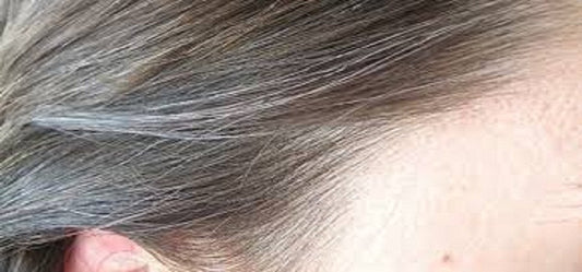 How To Tackle Premature Greying Of Hair
