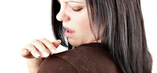 Dandruff: An Annual Problem And Its Remedies