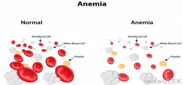 What Are The Key Causes Of Anemia