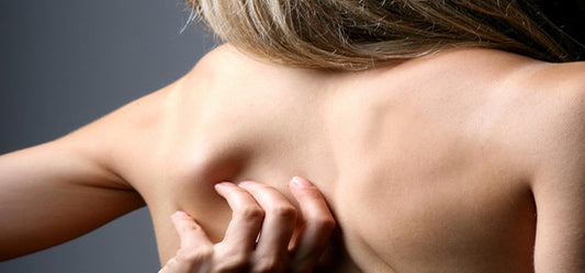 Simple Home Remedies To Treat Eczema